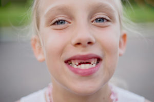 Child missing her two front teeth